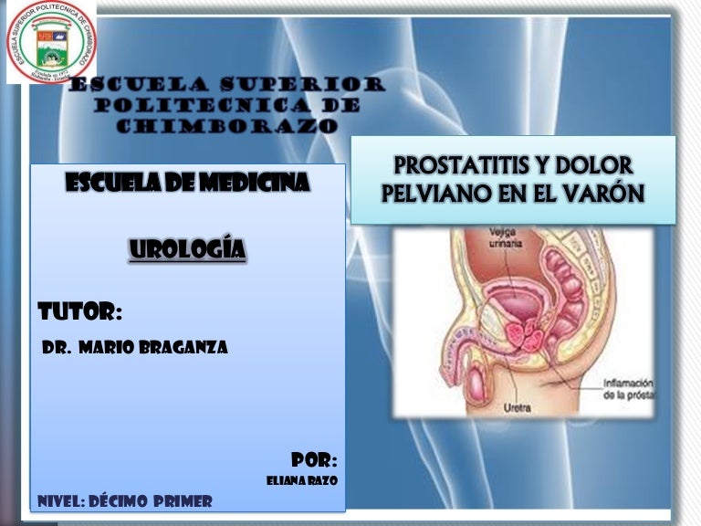 niveles de PSA después de la prostatitis