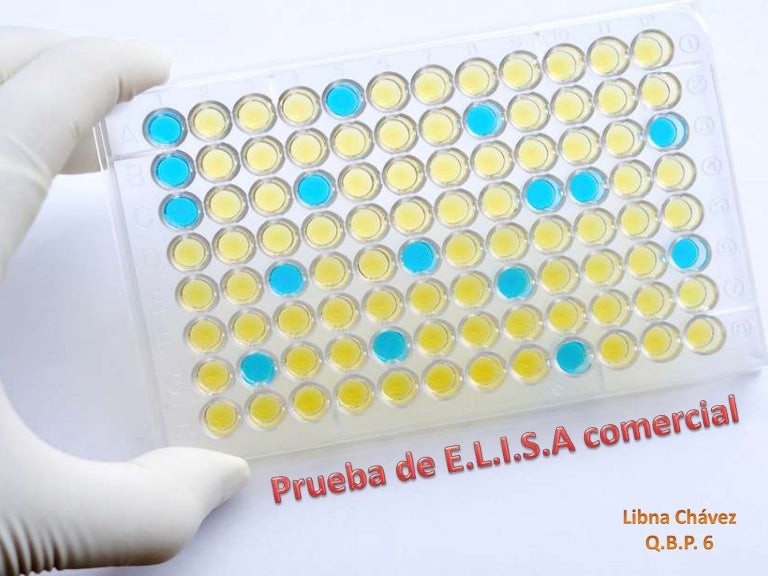 PRUEBA ELISA