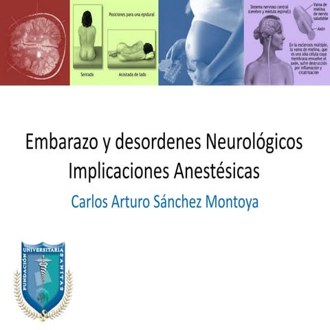 Embarazo y desordenes neurológicos