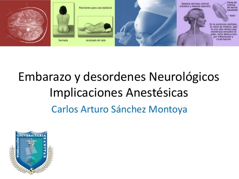 Propranolol para la hipertensión intracraneal