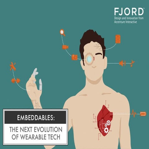 Embeddables: Technology that gets under your skin | PPT