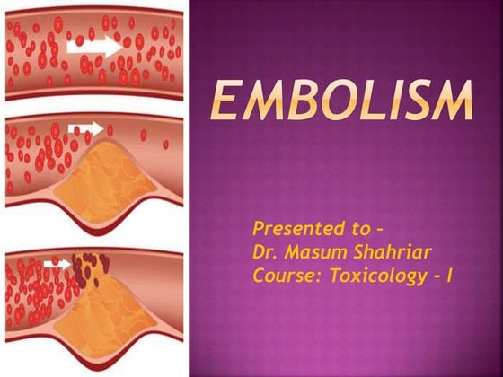 edema pathology | PPT