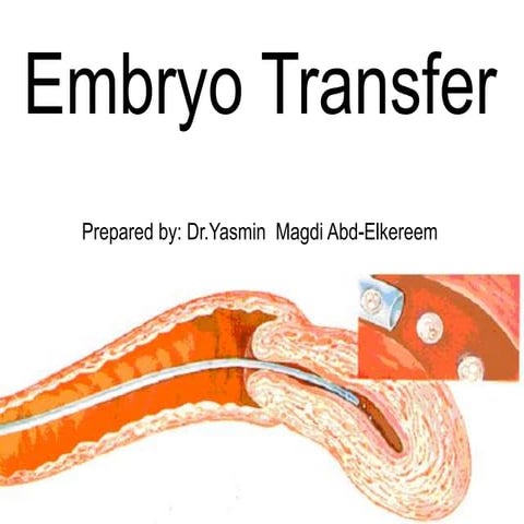 Embryo transfer