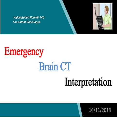 Emergency brain CT interpretation
