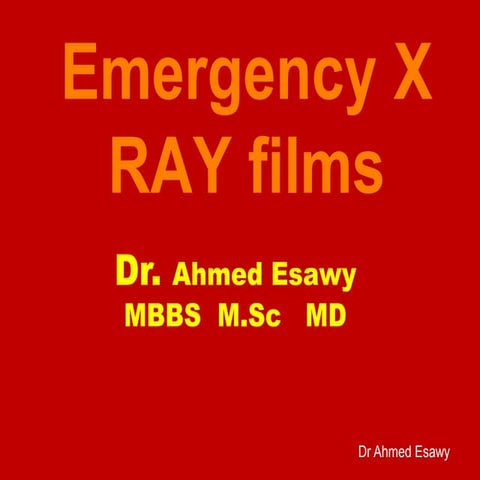 Emergency x ray films Dr Ahmed Esawy