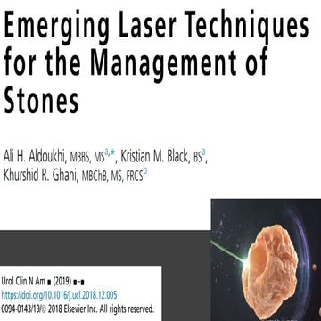 Laser Techniques for Urinary stones