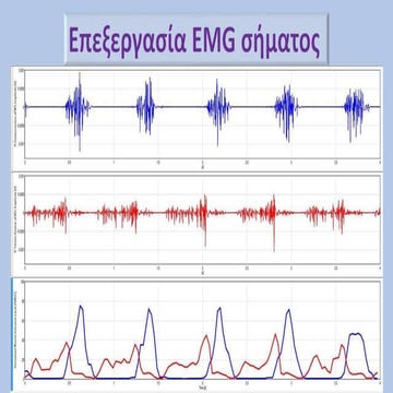 Comprehensive Guide to Electromyography (EMG) in Sports Science and ...