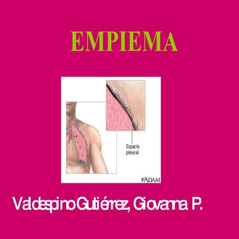 Empiema