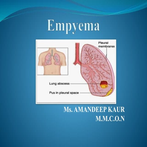 Empyema