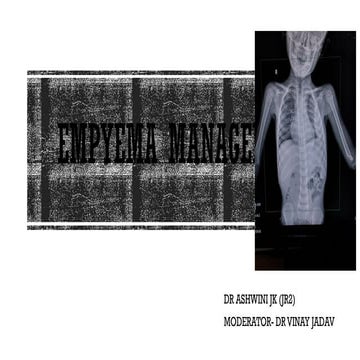 EMPYEMA MANAGEMENT 21ST.pptx..............