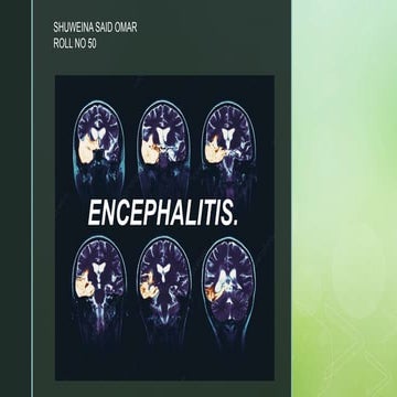 Encephalitis. Shuweina Said roll no 50..pptx