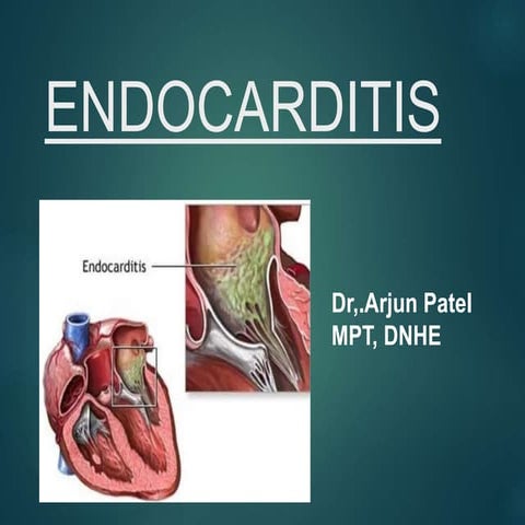 Endocarditis 