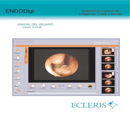 Endo digi manual | PDF
