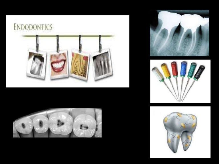 Endodontic mishaps/PROCEDURAL ACCIDENTS