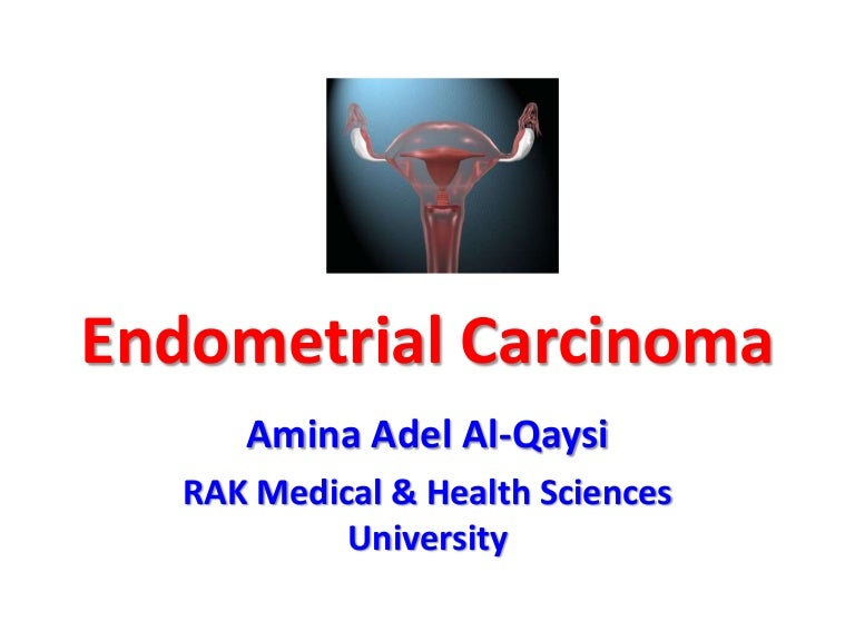 endometrium rák williams slideshare