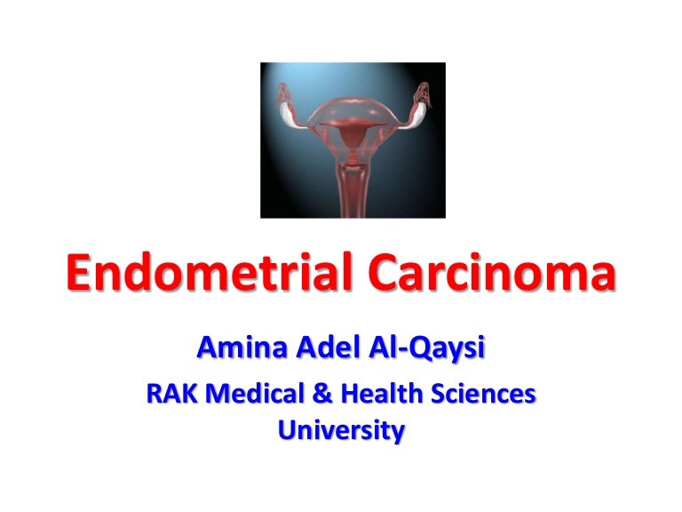 Endometrium rák és ösztrogén - szoboszlosound.hu