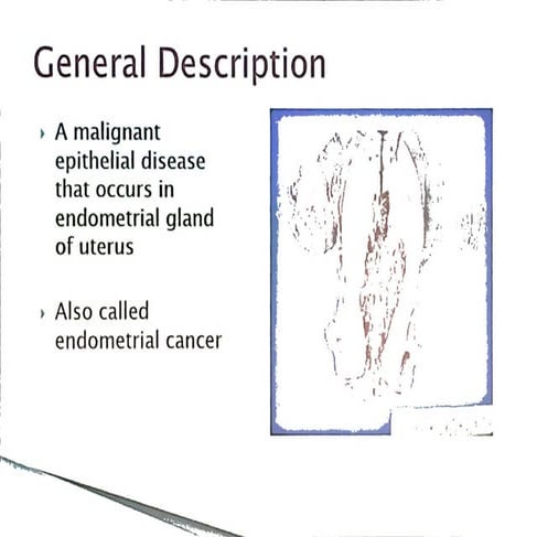 Endometrial Carcinoma - Gynaecology MBBS