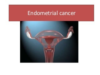 'endometrial cancer' on SlideShare
