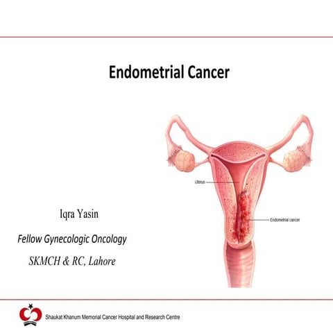 Endometrial cancer