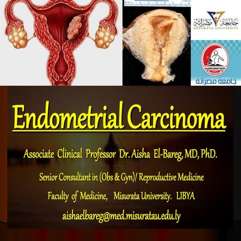 Endometrial carcinoma.lecture by Associate Professor Dr Aisha Elbareg