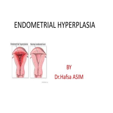 Endometrial hyperplasia