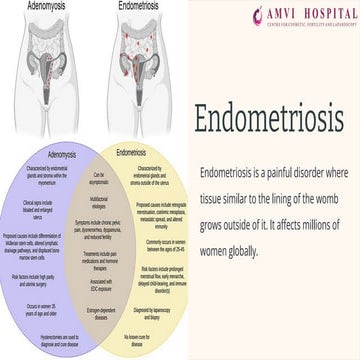 Endometriosis | PDF