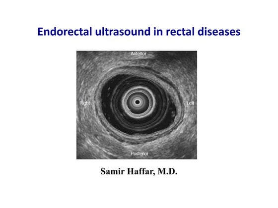 JNET classification of colo rectal polyps | PPTX | Medical Health
