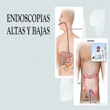 Endoscopia | PPTX