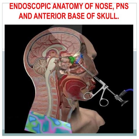 Diagnostic nasal endoscopy | PPTX
