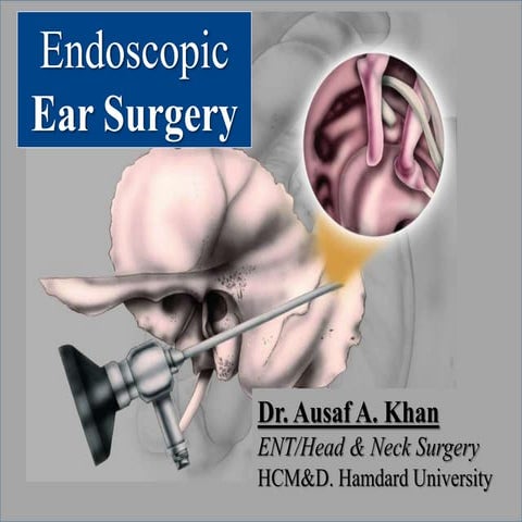 Endoscopic ear surgery