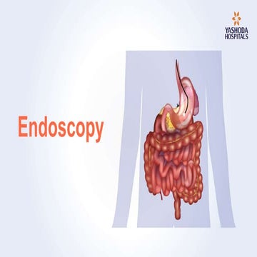 Endoscopy: Types, Preparation, Diagnosis, Procedure and Risks