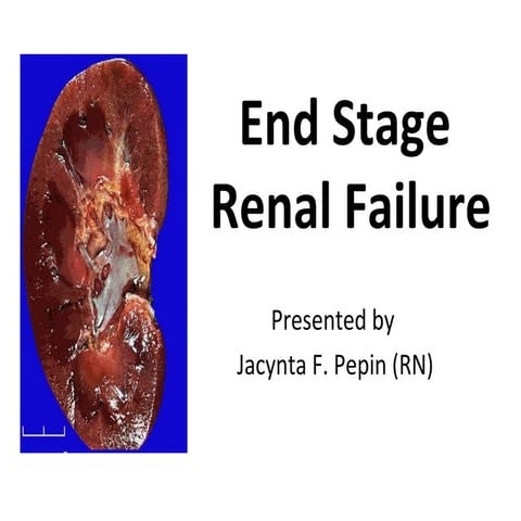 Case study: End stage renal failure