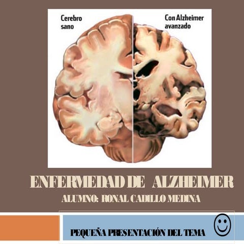 ALZHEIMER DISEASE  farmacología de neurologia