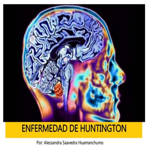 Enfermedad de huntington