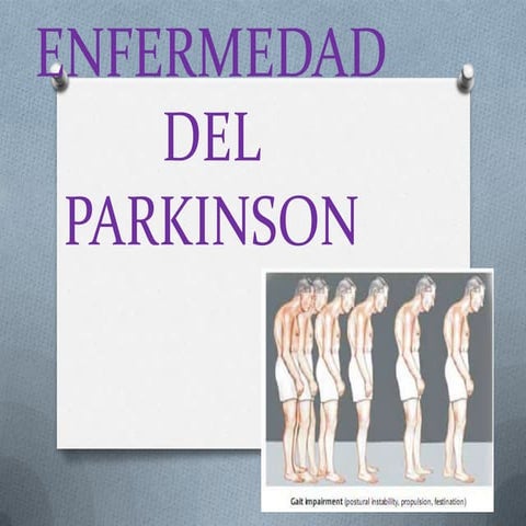 Enfermedad del parkinson