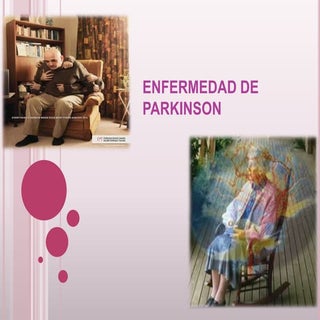 Enfermedad de parkinson