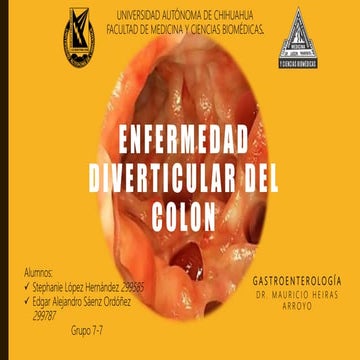 Enfermedad diverticular del colon 