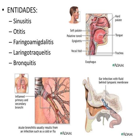 Enfermedades del sistema respiratorio