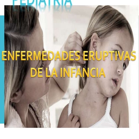 enfermedades    eruptiva  de la infancia