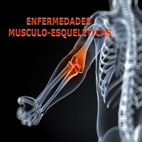 Enfermedades musculoesqueléticas