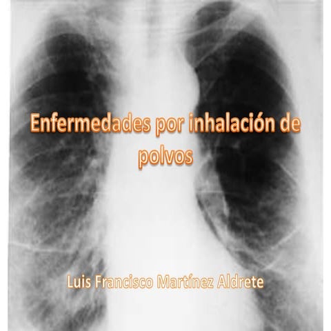 Enfermedades Por InhalacióN De Polvos
