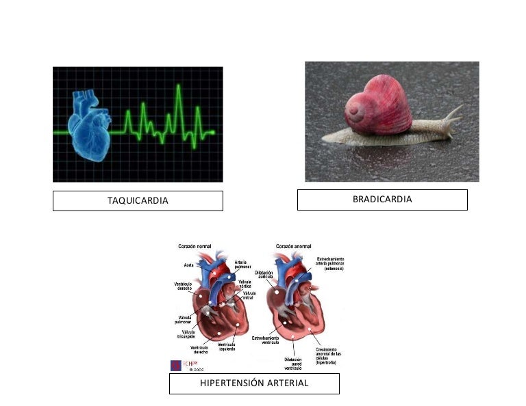 Enfermedades sistema circulatorio jul 2012