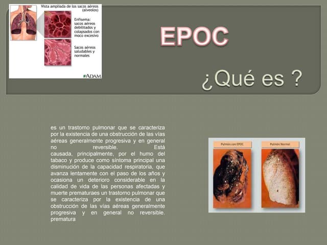 Enfermedad pulmonar