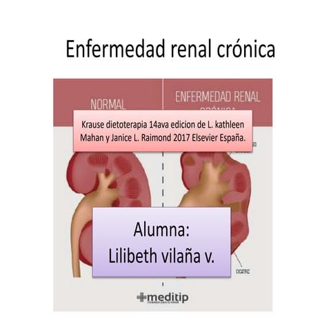 Enfermedad renal crónica.pptx