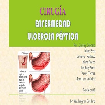Enfermedad ulcerosa paralelo b3