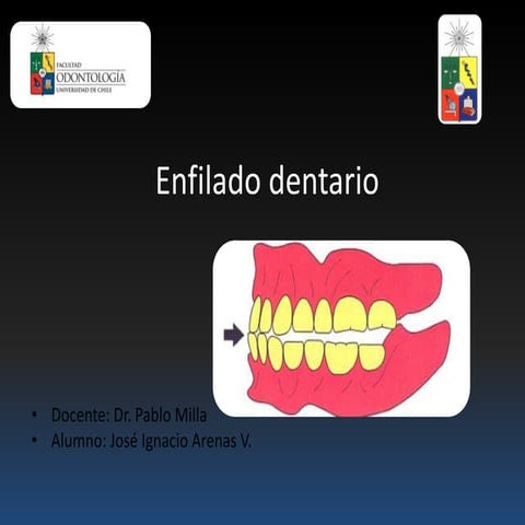 Enfilado dentario seminario 2014 | PPTX