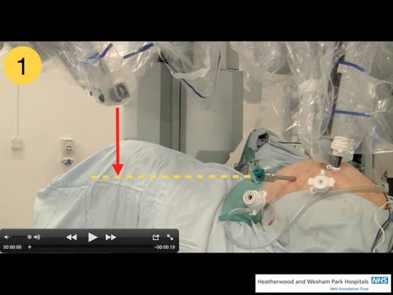 Patient positioning | PPT