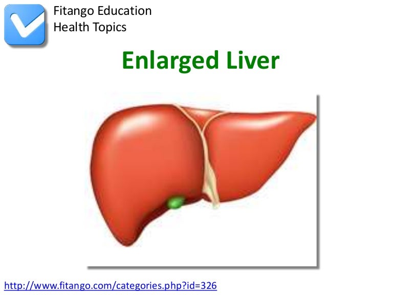 Enlarged Liver