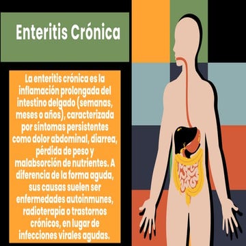 Comprehensive Overview of Ulcerative Colitis: Symptoms, Causes, and ...