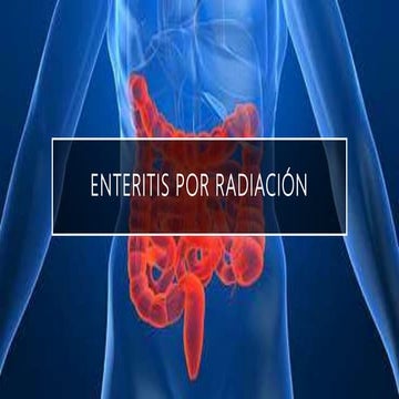 Enteritis por radiación | PPTX